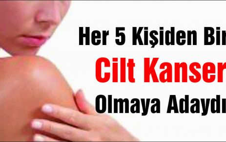 Her 5 Kişiden Biri  Cilt Kanseri  Olmaya Adaydır