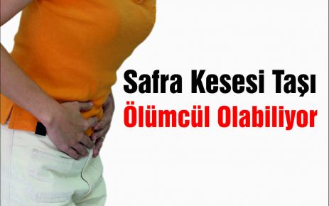 Safra Kesesi Taşı Ölümcül Olabiliyor  