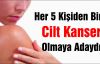 Her 5 Kişiden Biri Cilt Kanseri Olmaya Adaydır